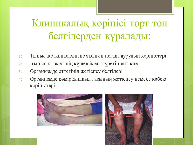 Клиникалық көрінісі төрт топ белгілерден құралады:     Тыныс жеткіліксіздігіне әкелген негізгі